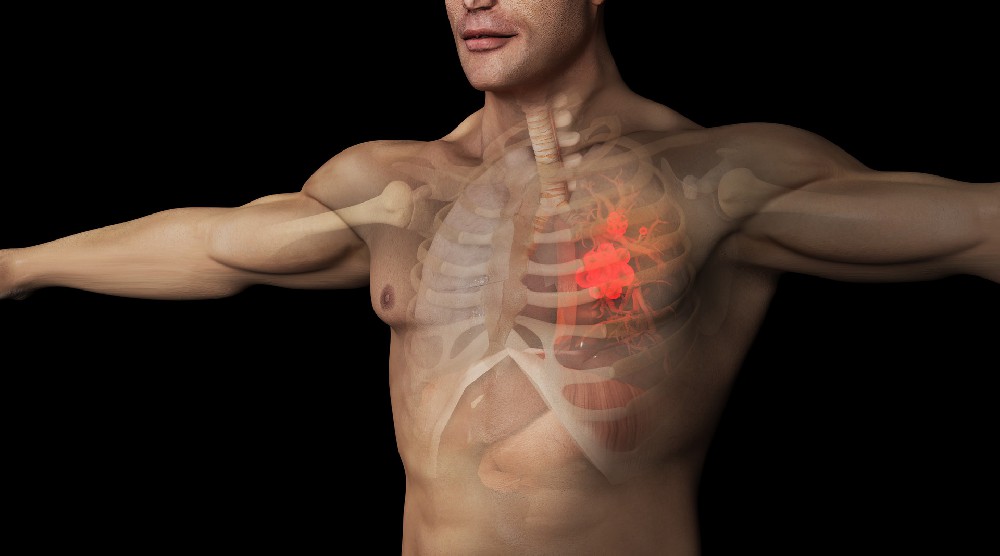 阳虚体质易招癌?5 招从根上养阳气!帮你稳住康复态