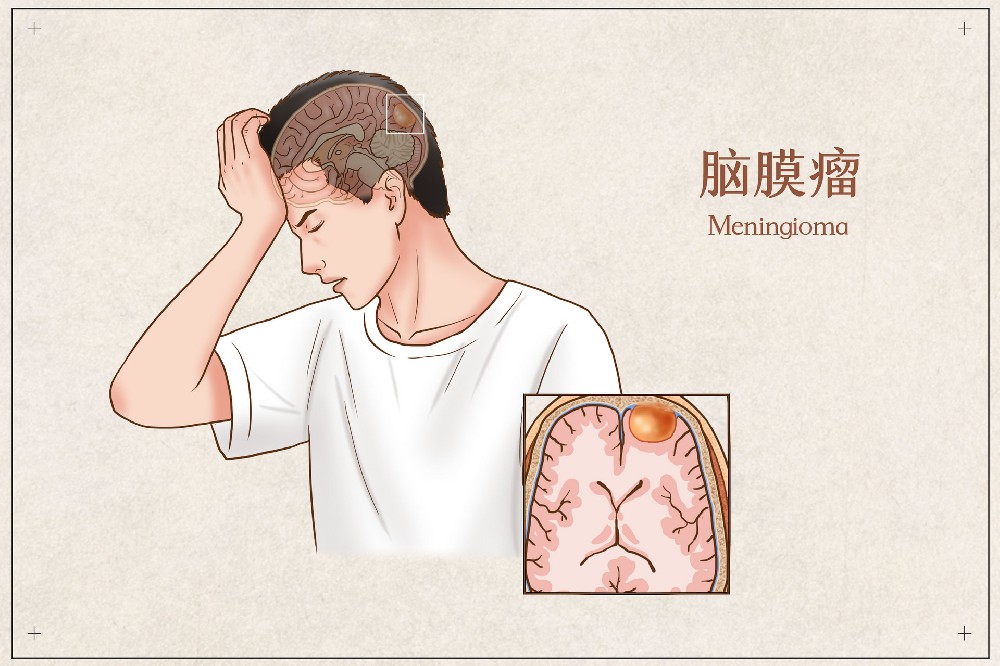 脑瘤术后选择中医治疗的好处有哪些？