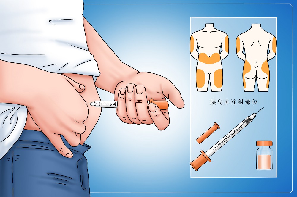 经常腹泻，原来是糖尿病惹的祸