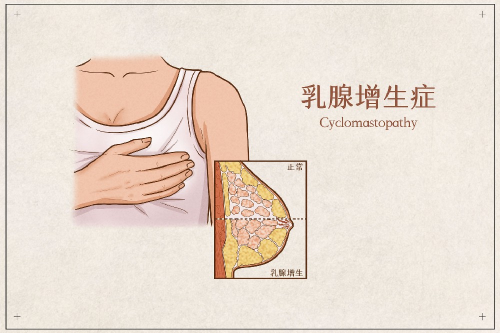 乳腺增生都有哪些症状？