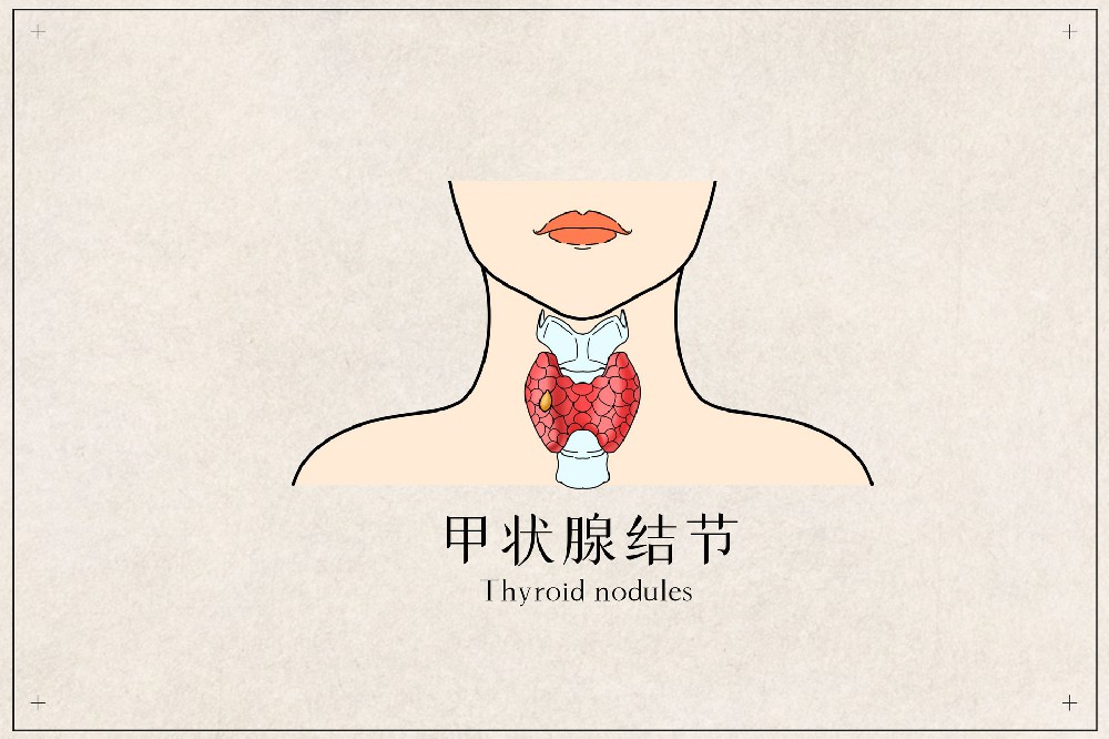 赵春天主任：常见的甲状腺疾病都有哪些？