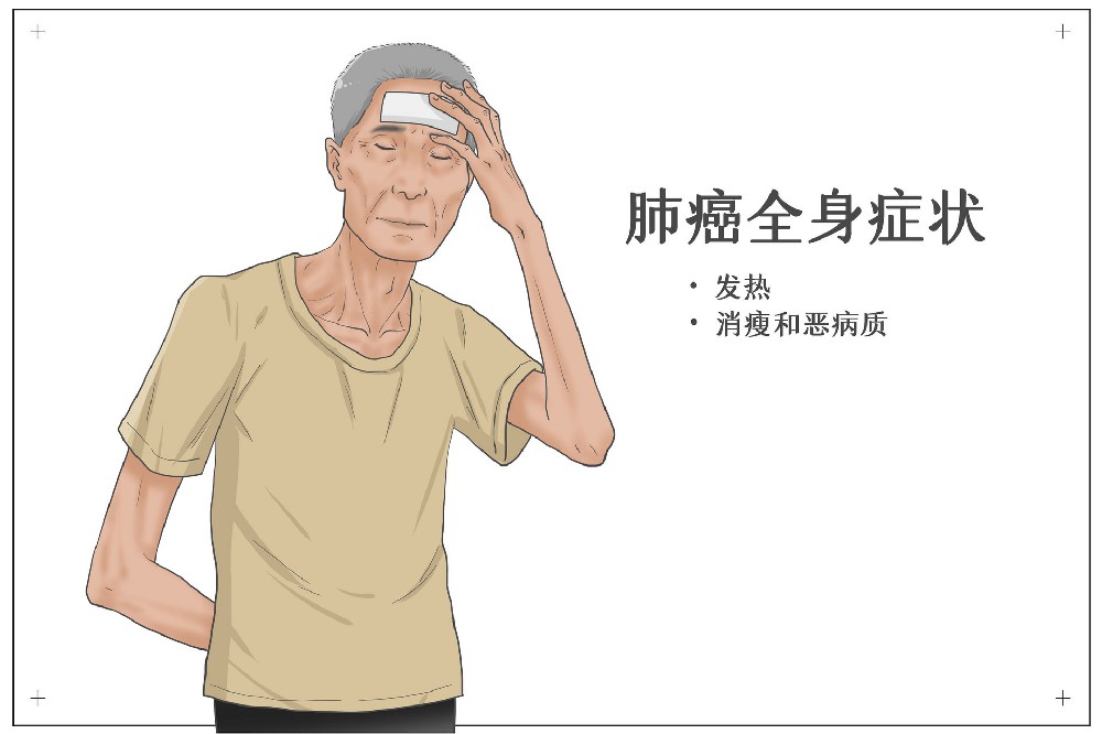 成都平安医院肿瘤科赵春天：肺癌晚期患者呼吸困难怎么办？