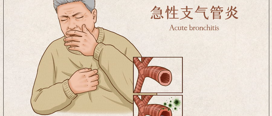 摄图网_401799104_wx_急性支气管炎医疗插画（企业商用）.jpg