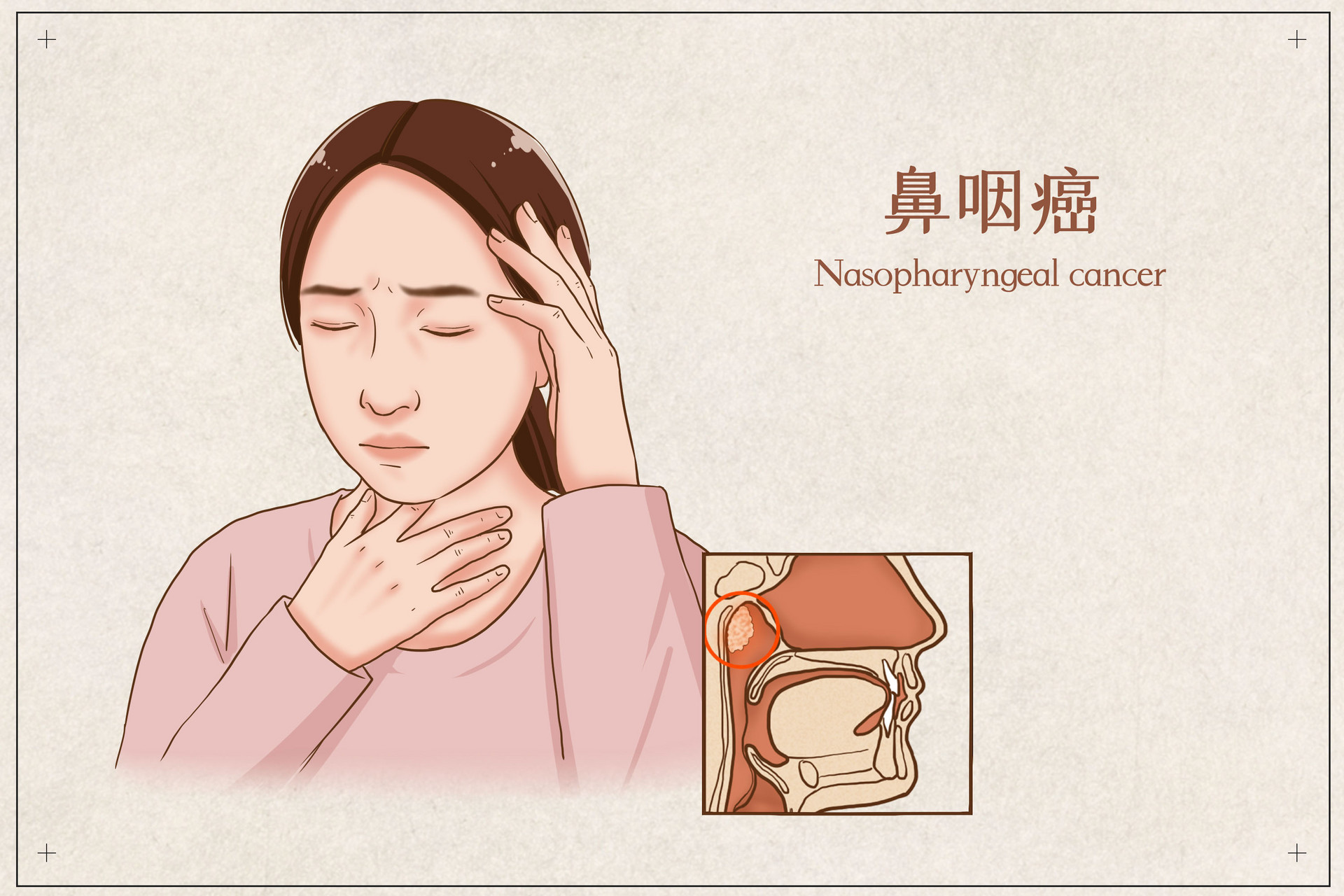 摄图网_401866466_banner_鼻咽癌医疗插画（企业商用）.jpg
