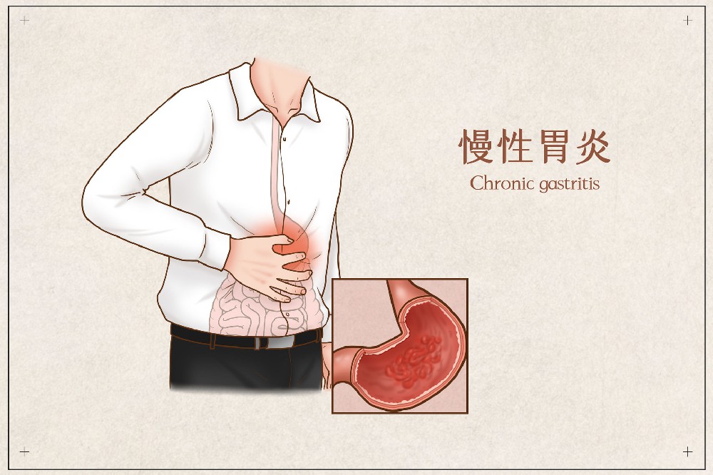 樊君主任：萎缩性胃炎，5大典型症状，中医教你5招，快速消除！
