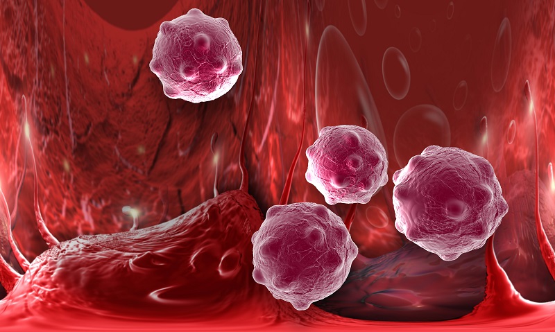 肿瘤治疗的核心，是帮患者做好免疫重建！