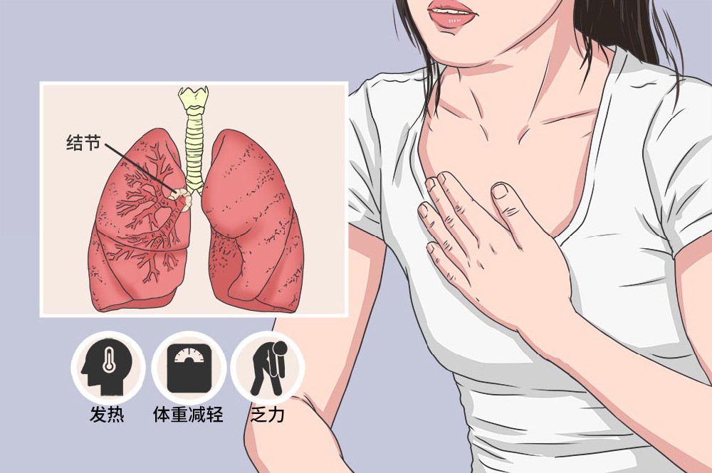 如何预防肺结节？